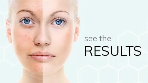 An Experience Beauty Clinic, located in the Melbourne CBD, sells Essel Products. See the results with Essel